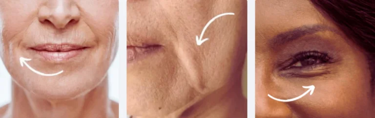 Benefits of South Beach Collagen Filler Serum